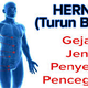 Illustration for article titled Obat Hernia Anak